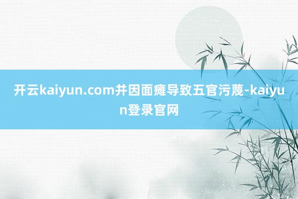 开云kaiyun.com并因面瘫导致五官污蔑-kaiyun登录官网